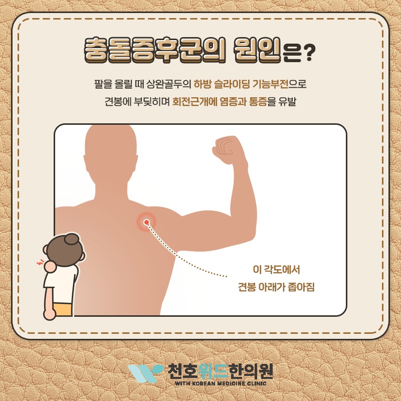 충돌증후군에서 나타나는 어깨 관절 압통의 특징