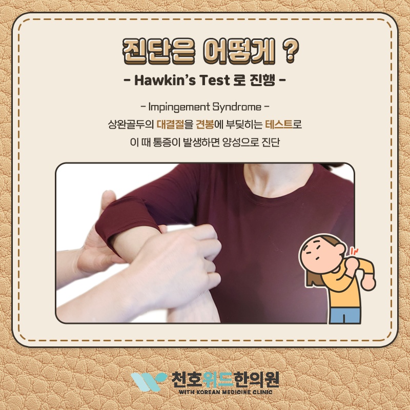 충돌증후군에서 나타나는 어깨 관절 압통의 특징