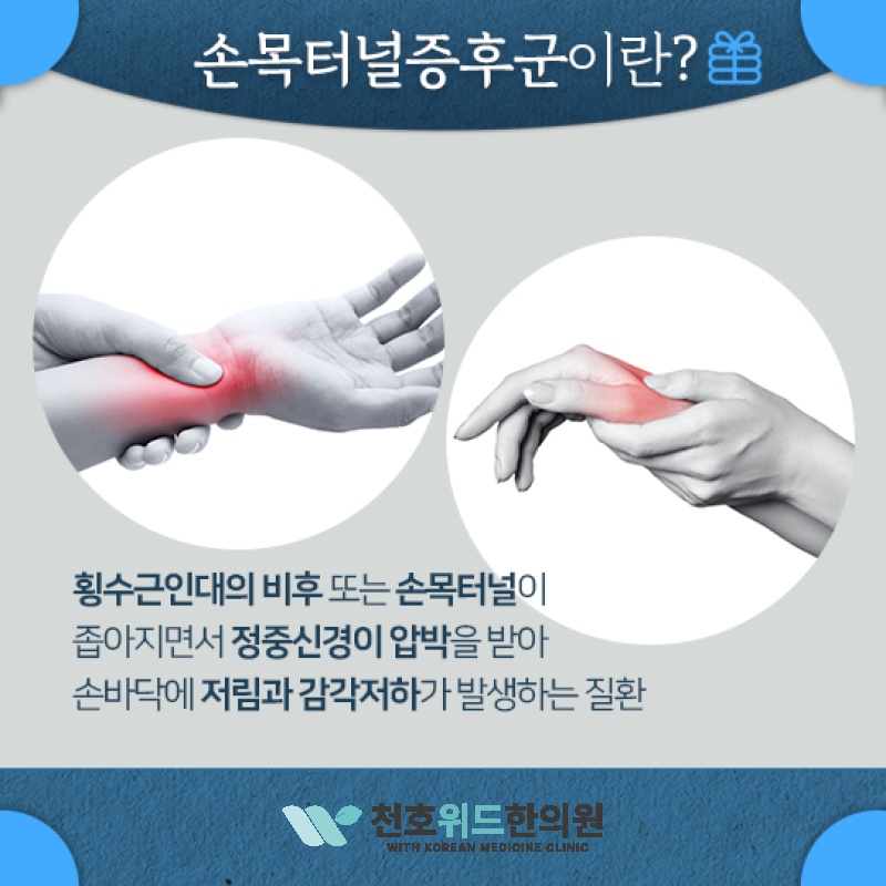손목터널증후군, 저림이 되풀이될 때 살펴볼 점