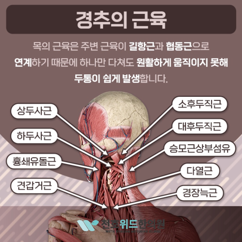 뒷목과 어깨가 뻣뻣한 일상, 경추성두통과 관련 있을까요