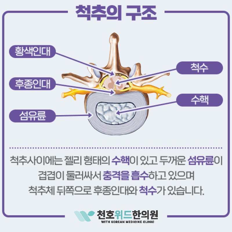 장시간 앉아 지내는 직장인, 허리디스크 주의가 필요합니다