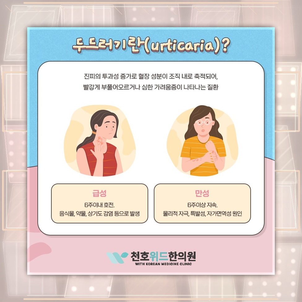 예고 없이 나타난 두드러기, 원인을 살펴보는 방법