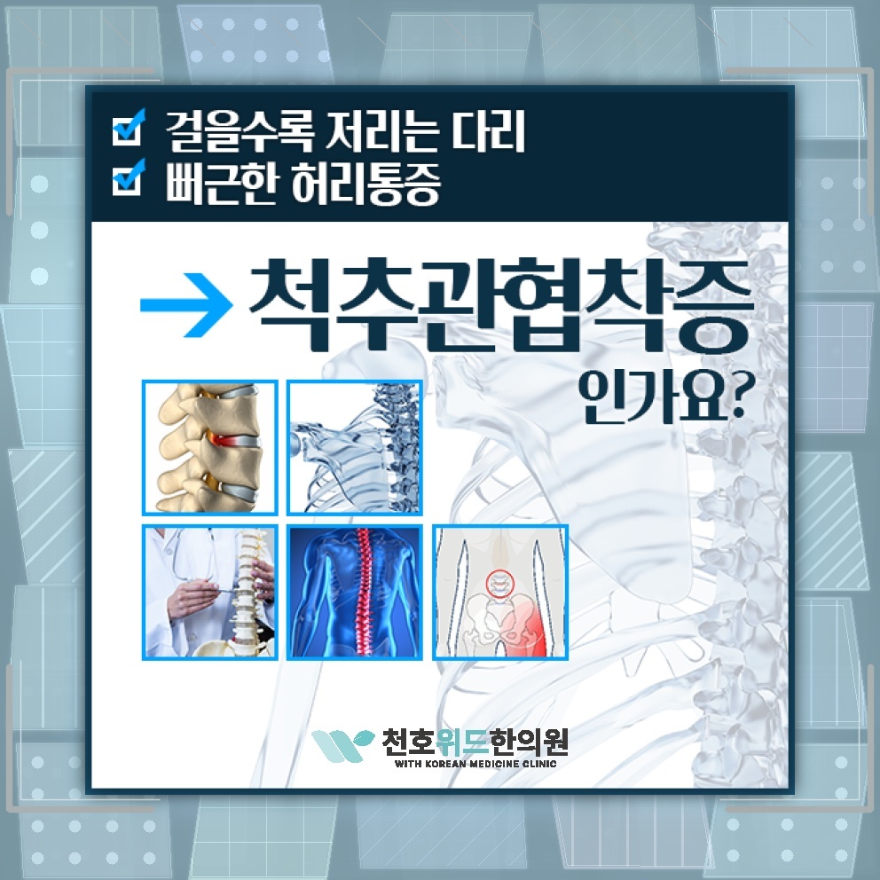 척추관협착증의 퇴행성 진행을 살피는 생활 관리