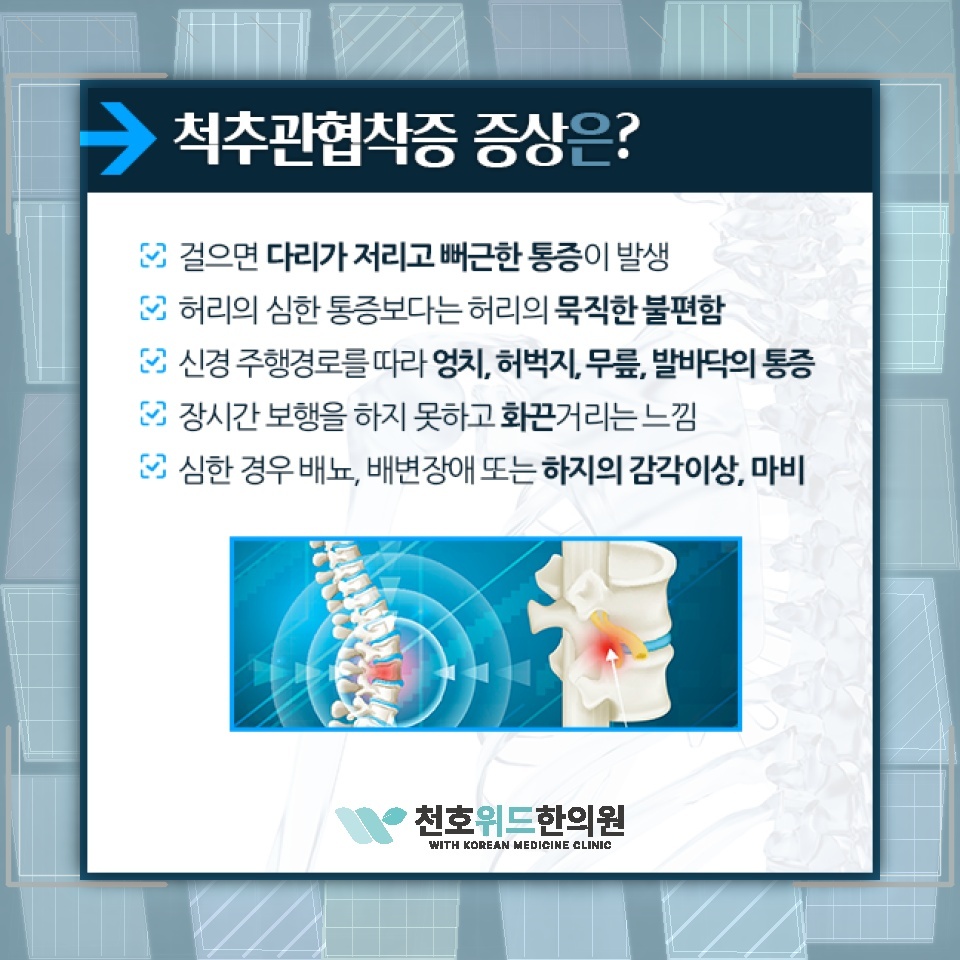 척추관협착증의 퇴행성 진행을 살피는 생활 관리