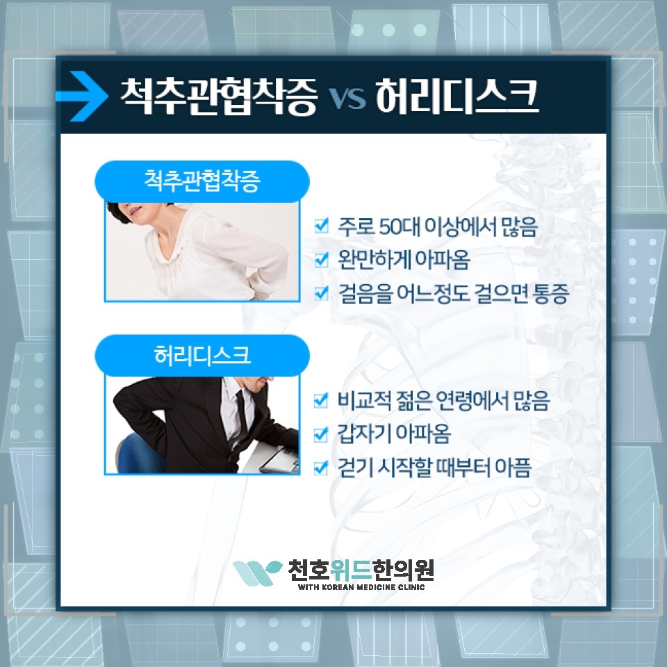 척추관협착증의 퇴행성 진행을 살피는 생활 관리