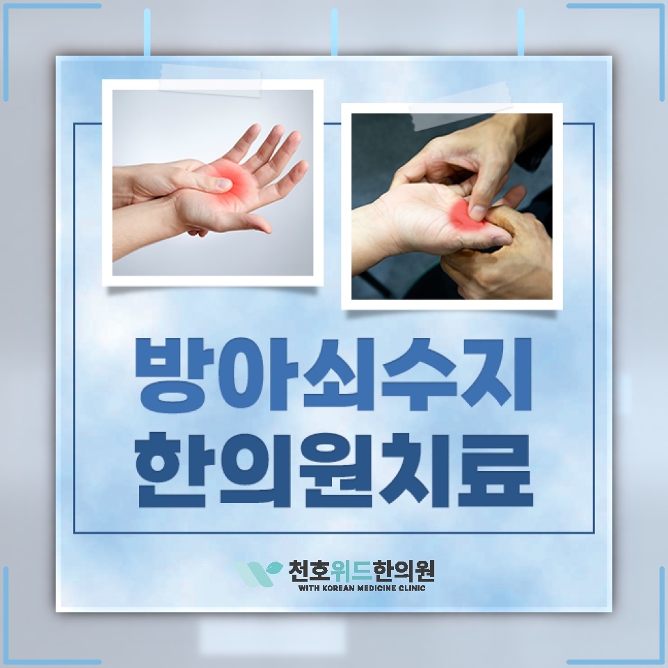 손가락을 펼 때 걸리는 느낌, 방아쇠수지의 주요 증상