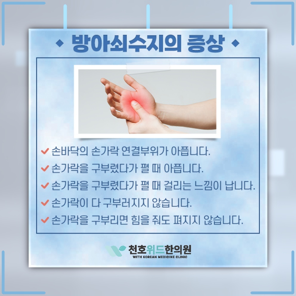 손가락을 펼 때 걸리는 느낌, 방아쇠수지의 주요 증상