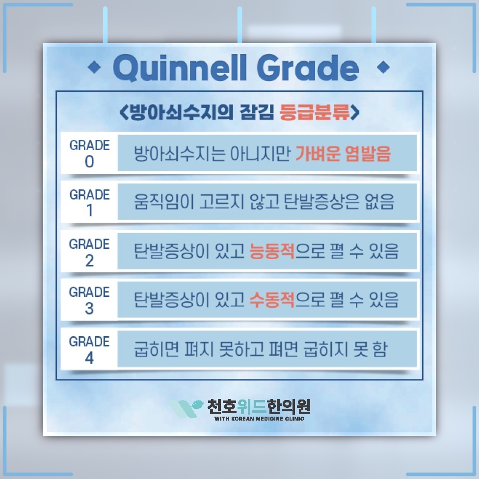 손가락을 펼 때 걸리는 느낌, 방아쇠수지의 주요 증상