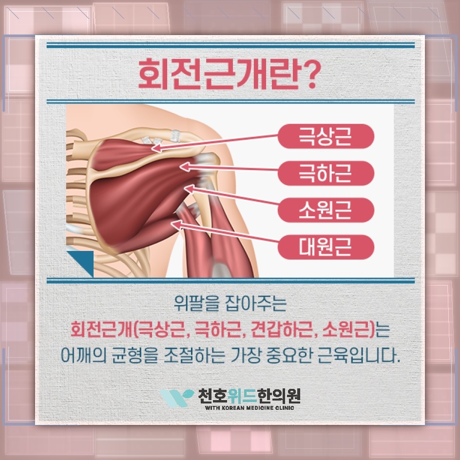 회전근개파열 뒤 지속되는 어깨 힘줄 염증의 원인