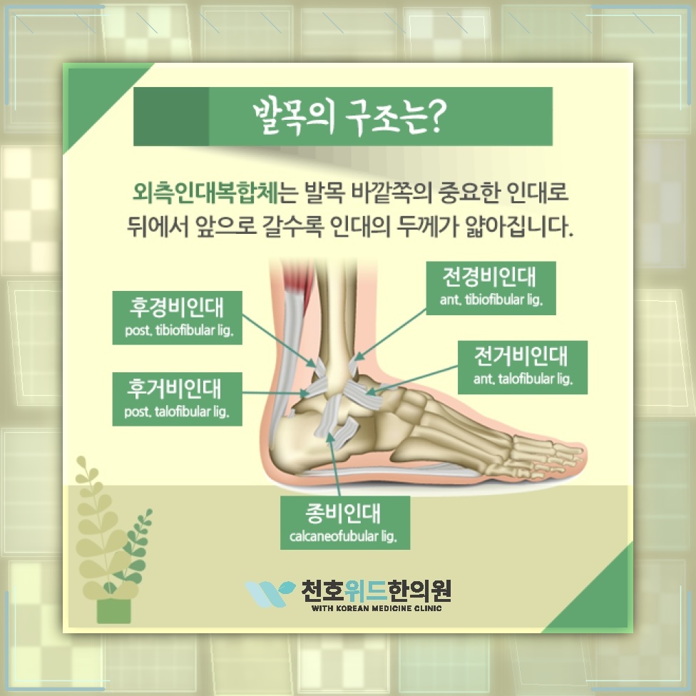 발목염좌 뒤 약해진 인대가 관절 불안정으로 이어질 때