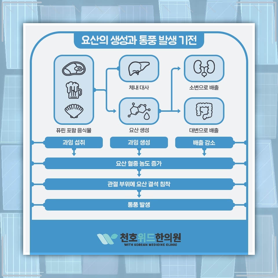 발가락 관절에 흔히 나타나는 통풍의 주요 발생 부위
