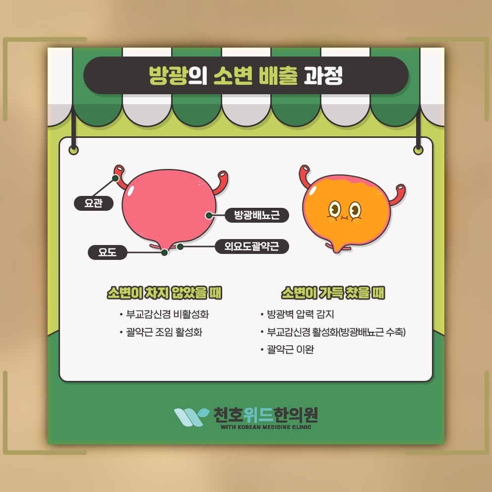 요실금으로 흔들리는 자존감과 일상 속 스트레스