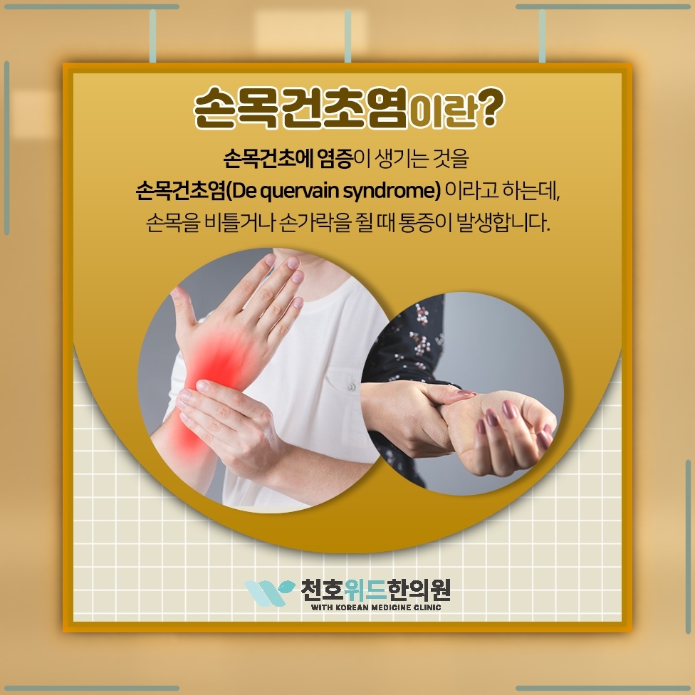 반복 동작과 과도한 사용으로 생기는 손목건초염